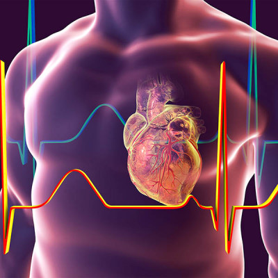 Cardiology Heart Failure