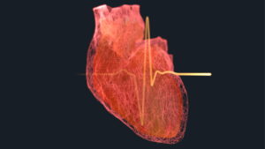 Cardiology1 heart failure Course